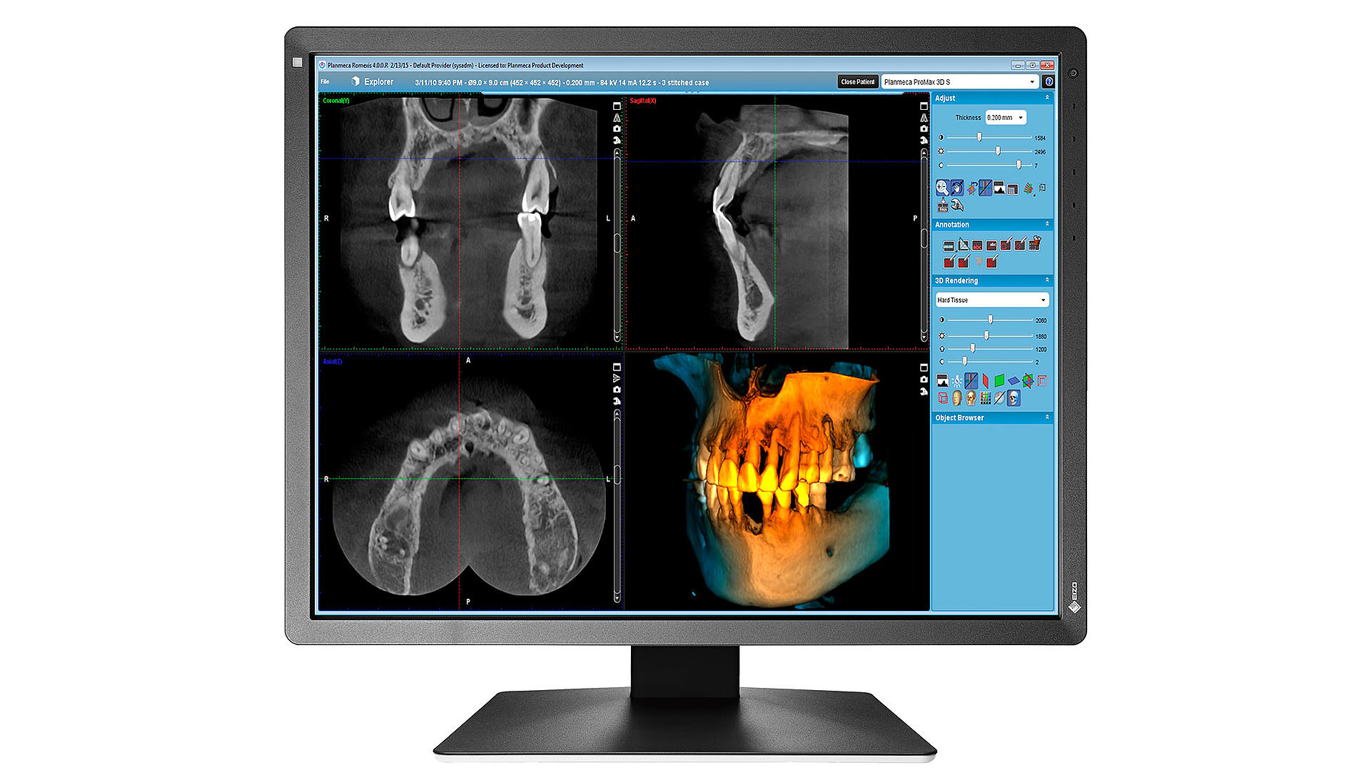 EIZO RadiForce MX216-SB computer monitor – image 1
