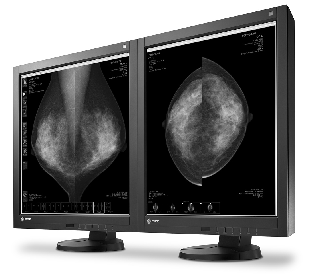 EIZO RadiForce GX540 – image 3