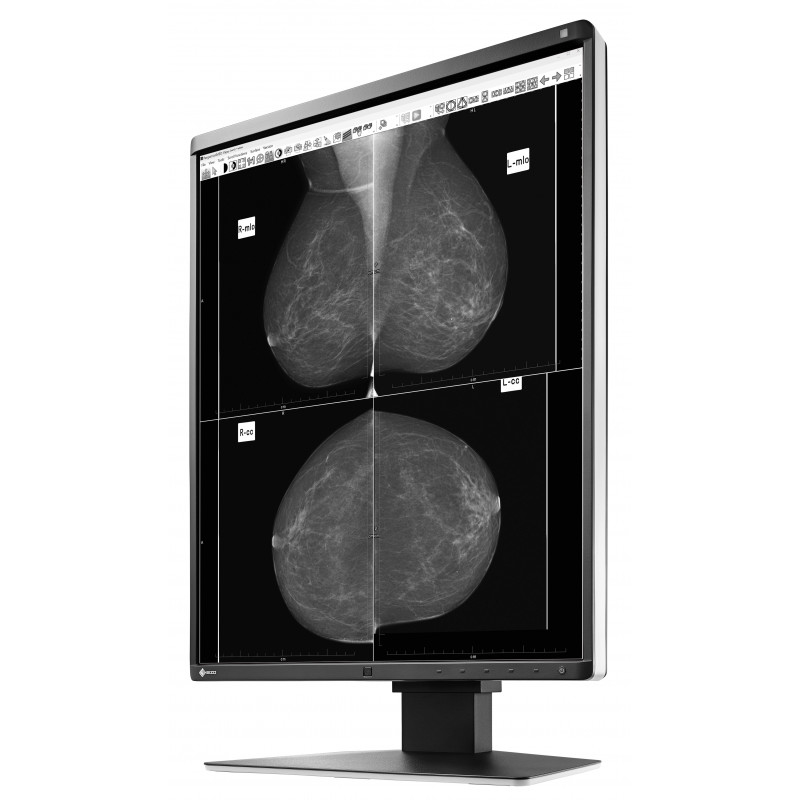 EIZO RadiForce GX560 computer monitor – image 3