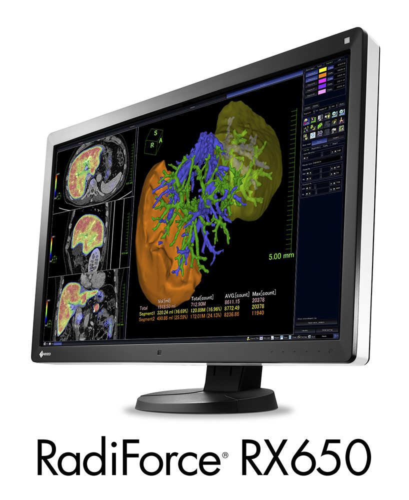 EIZO RadiForce RX650 – image 2