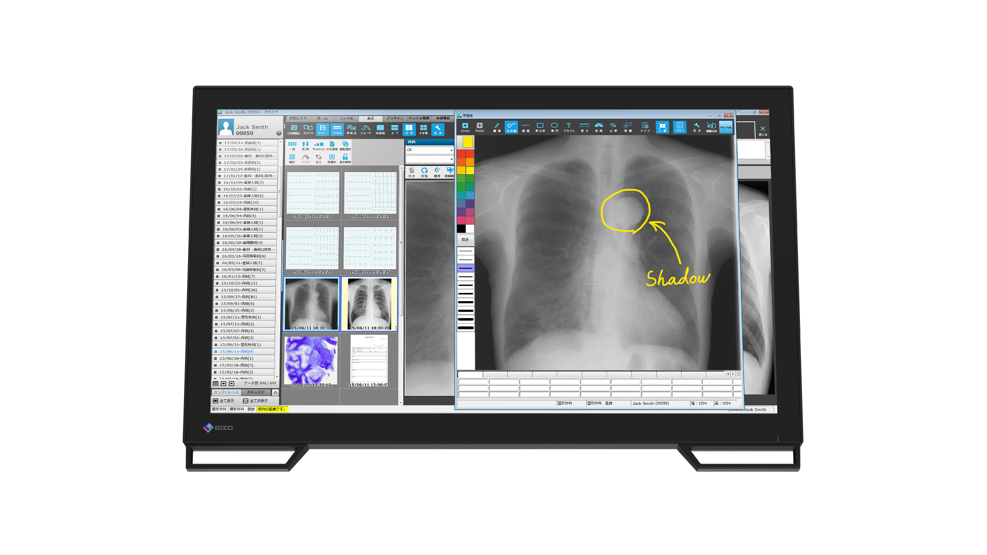 EIZO RadiForce MS236WT computer monitor – image 9
