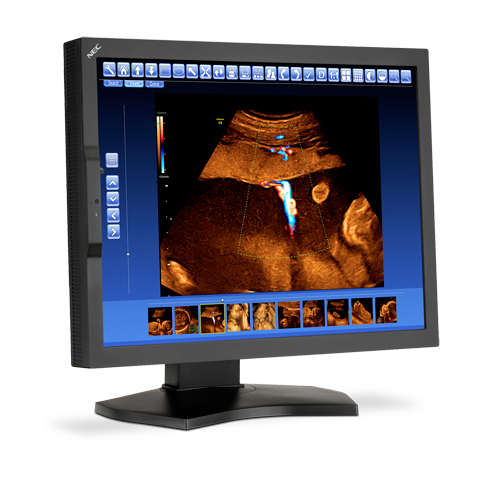 NEC MD210C2 computer monitor – image 3