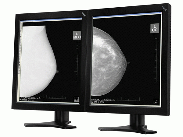 NEC MD205MG-1 20.1" LCD Display – image 2