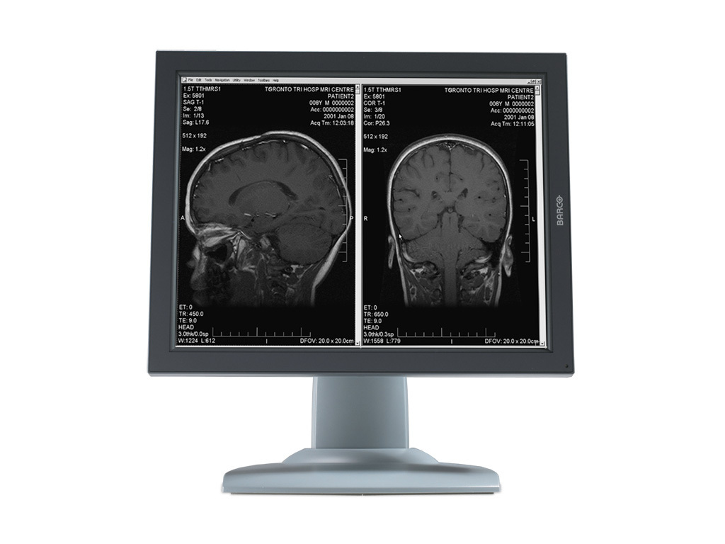 Barco MDNG-2121 computer monitor