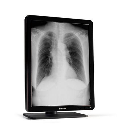 Barco MDNG-3220 computer monitor