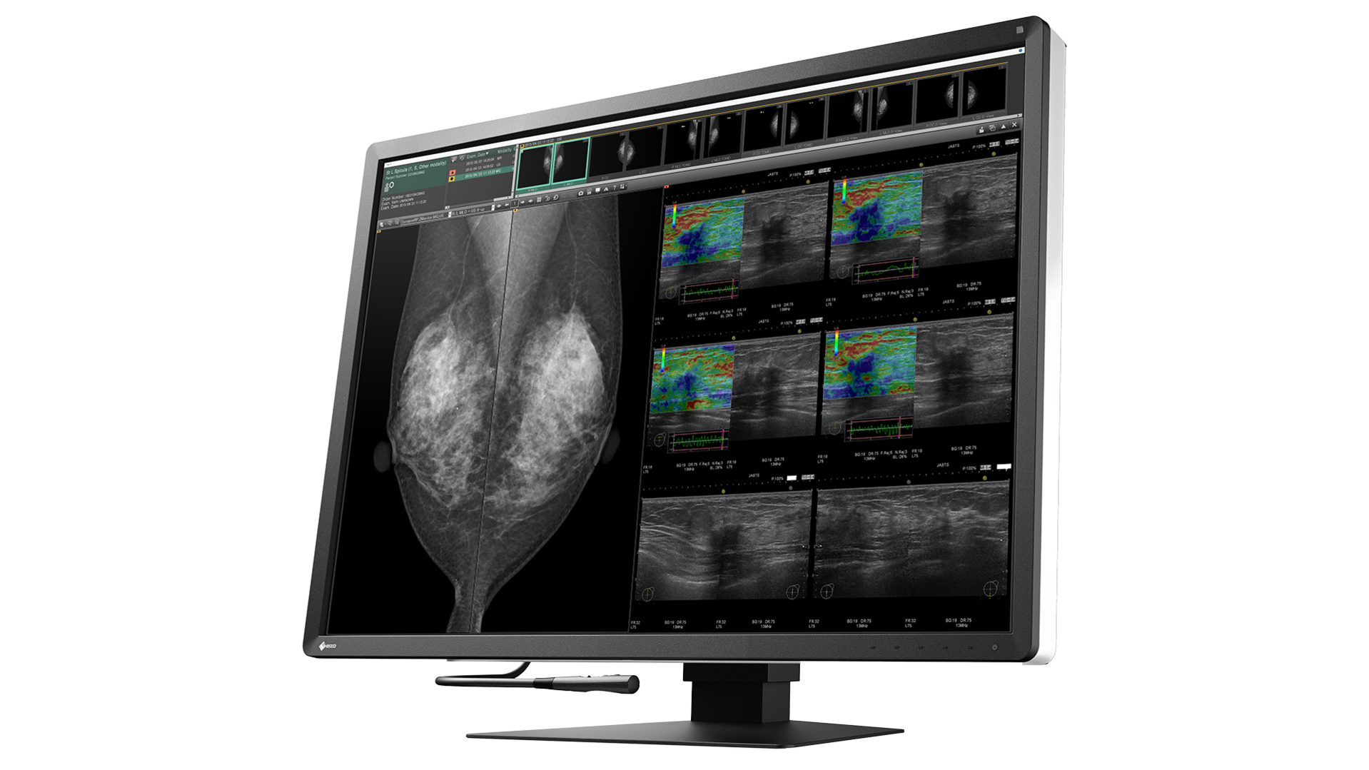 EIZO RadiForce RX1270 computer monitor – image 3