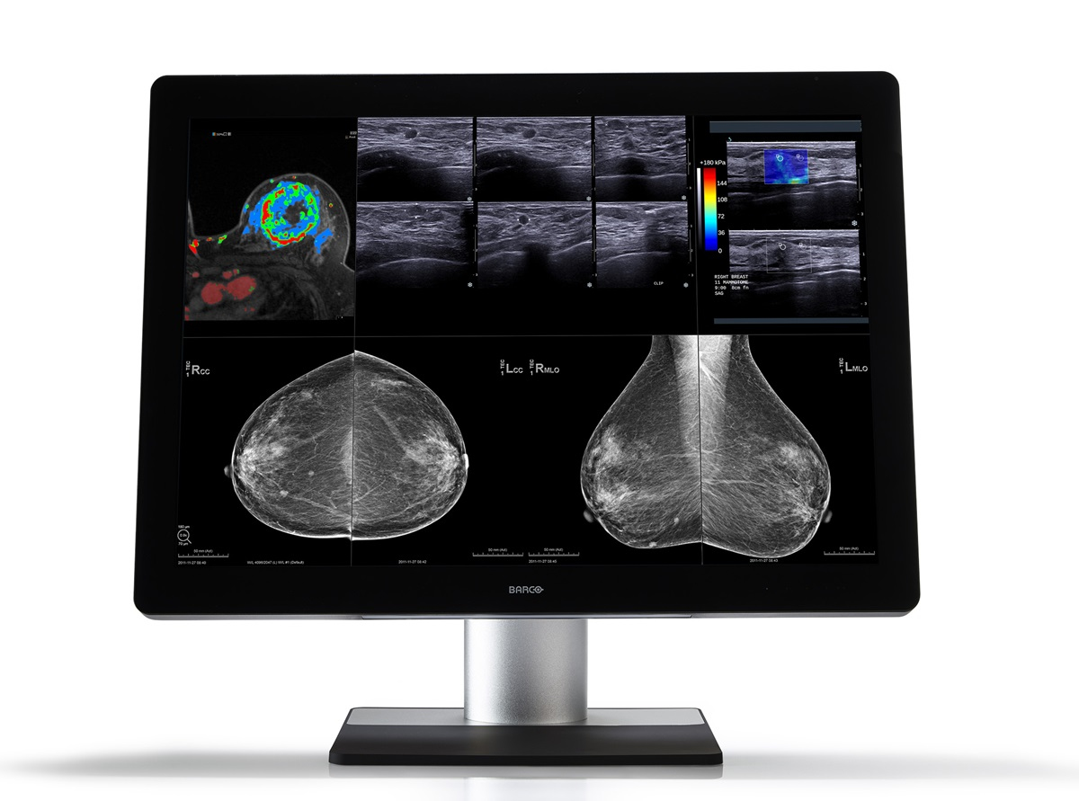 Barco MDMC-12133 computer monitor – image 1