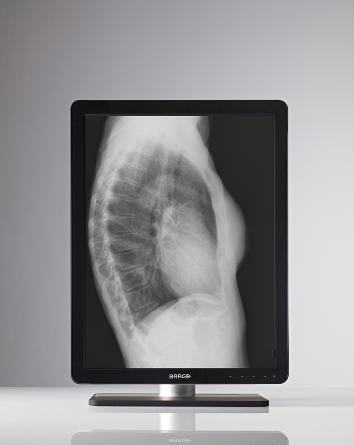 Barco MDCG-3221 computer monitor – image 4