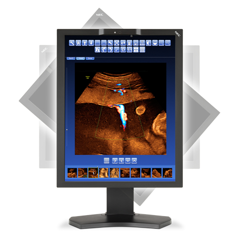 NEC MD210C2 computer monitor – image 8