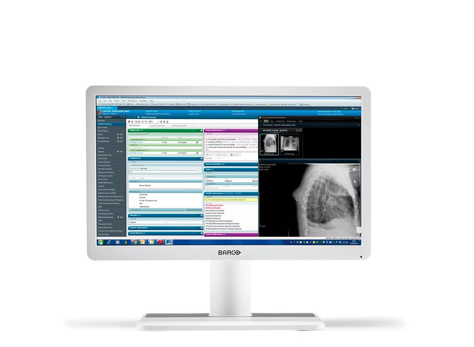 Barco MDRC‑2222 computer monitor – image 1