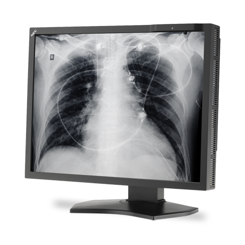 NEC MD211G3 computer monitor – image 6