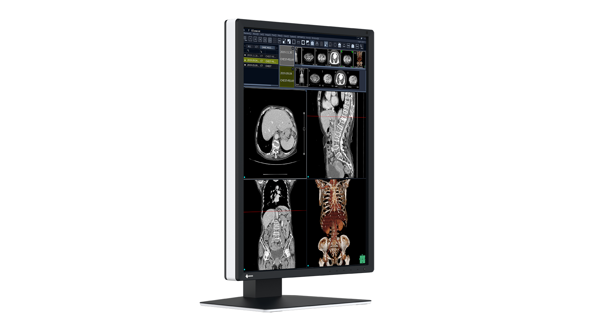 EIZO RadiForce RX270 computer monitor – image 3