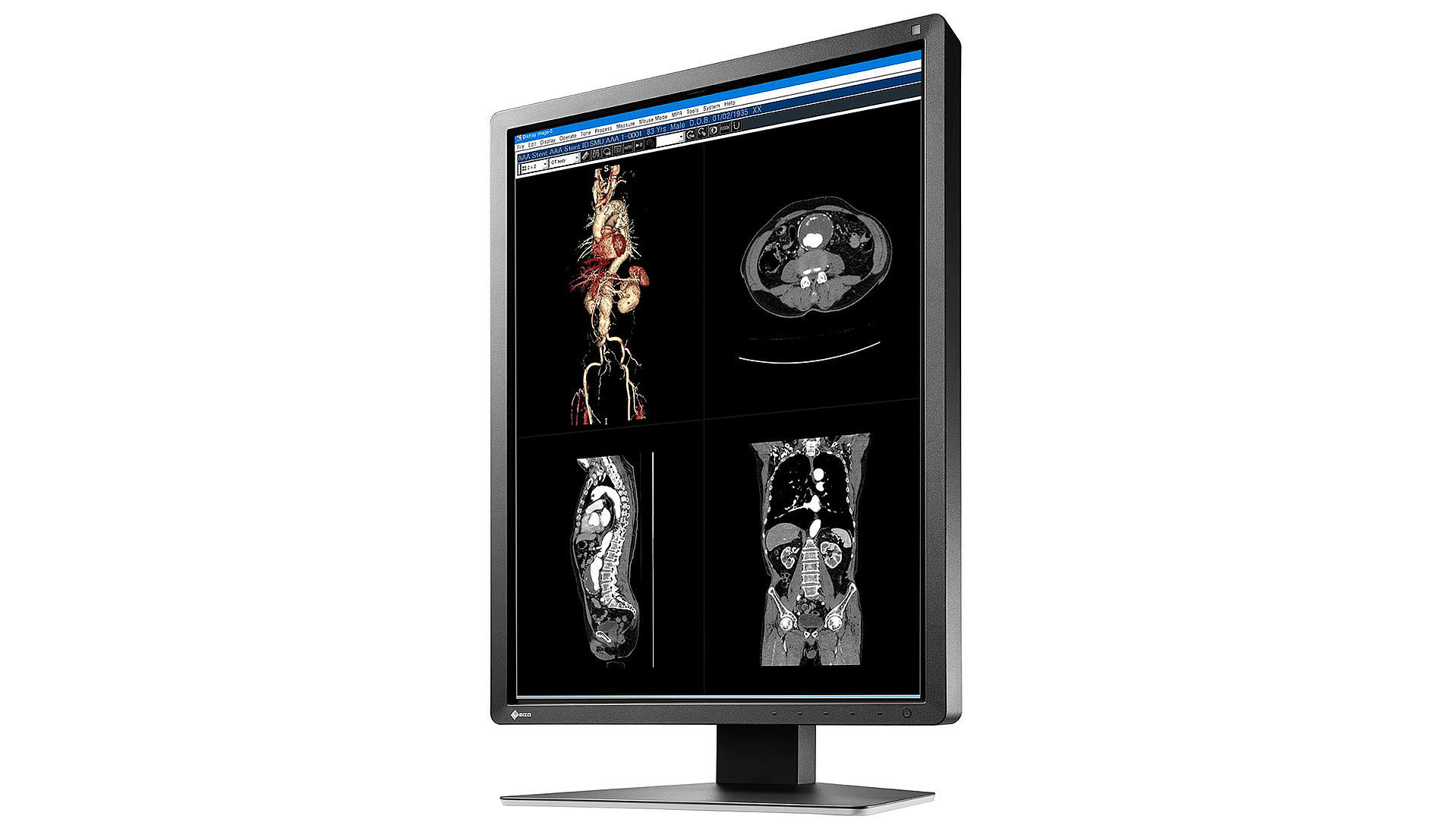 EIZO RadiForce MX216-SB computer monitor – image 6