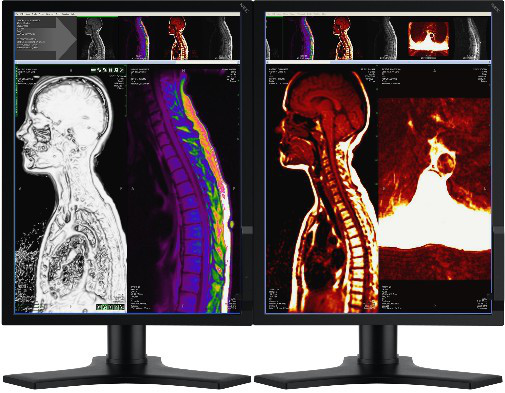 NEC MD212MC 21.3" LCD Display – image 2
