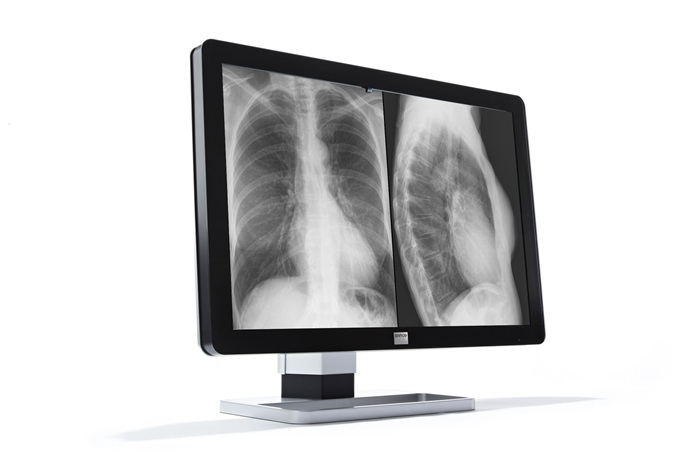 Barco MDCC-6230 computer monitor