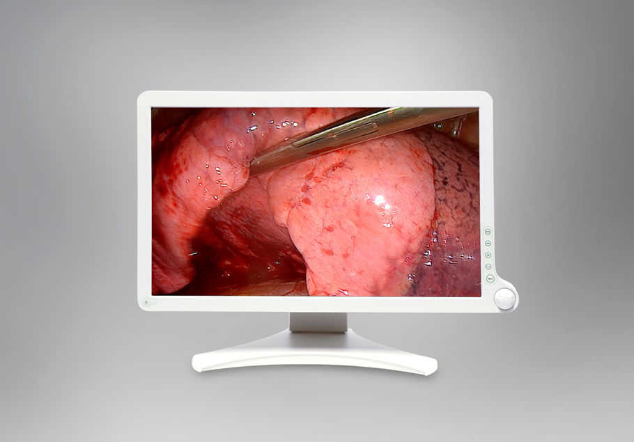 Barco 215EFZUS computer monitor