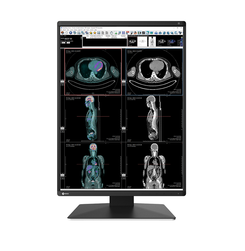 EIZO RadiForce RX370 computer monitor