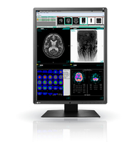 EIZO EIZO RadiForce RX350 Computerbildschirm 54,1 cm (21.3 Zoll) 1536 x 2048 Pixel LCD Schwarz https://images.icecat.biz/img/gallery_lows/32024511_2955824902.jpg EIZO EIZO RadiForce RX350 Computerbildschirm 54,1 cm (21.3 Zoll) 1536 x 2048 Pixel LCD Schwarz https://images.icecat.biz/img/gallery_lows/32024511_2955824902.jpg