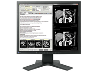 EIZO EIZO RadiForce MX194 LED display 48,3 cm (19") 1280 x 1024 Pixel LCD Schwarz https://images.icecat.biz/img/gallery_lows/65600224_2102934876.jpg EIZO EIZO RadiForce MX194 LED display 48,3 cm (19") 1280 x 1024 Pixel LCD Schwarz https://images.icecat.biz/img/gallery_lows/65600224_2102934876.jpg