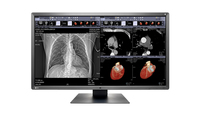 EIZO EIZO RadiForce MX317W LED display 79 cm (31.1 Zoll) 4096 x 2160 Pixel 4K Ultra HD Schwarz https://images.icecat.biz/img/gallery_lows/71781939_7213625082.jpg EIZO EIZO RadiForce MX317W LED display 79 cm (31.1 Zoll) 4096 x 2160 Pixel 4K Ultra HD Schwarz https://images.icecat.biz/img/gallery_lows/71781939_7213625082.jpg