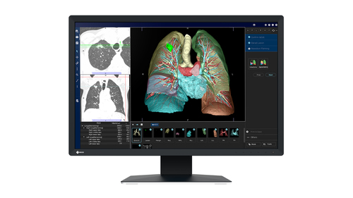 2.3MP EIZO RADIFORCE MX243W