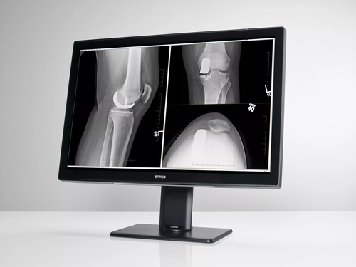 Barco MDCC‑4430 computer monitor – image 2