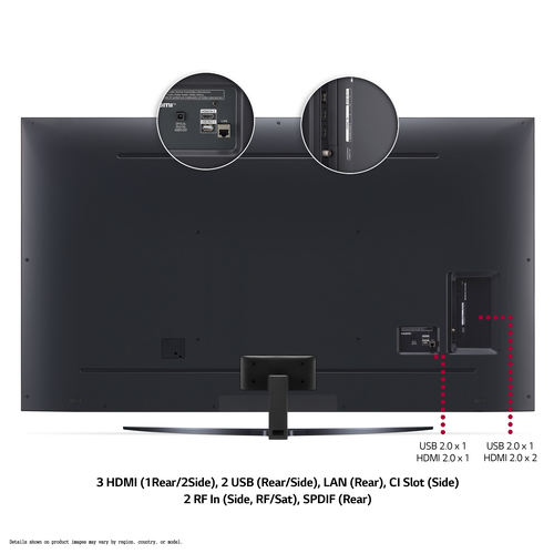 LG 75UP81006LA.AEK TV – image 8