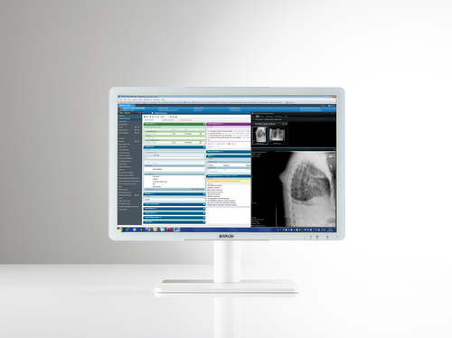 Barco MDRC‑2222 computer monitor – image 2
