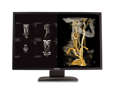 Barco MDNC-4130 computer monitor