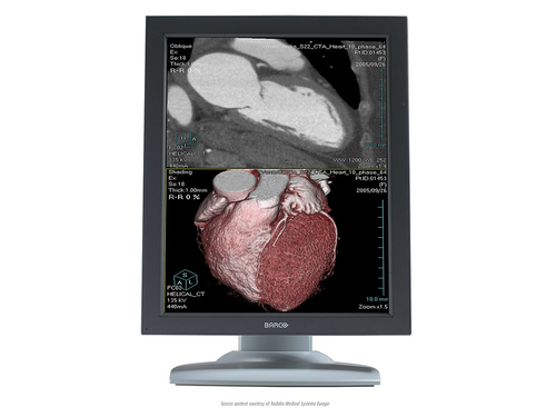 Barco MDNC-3121 computer monitor