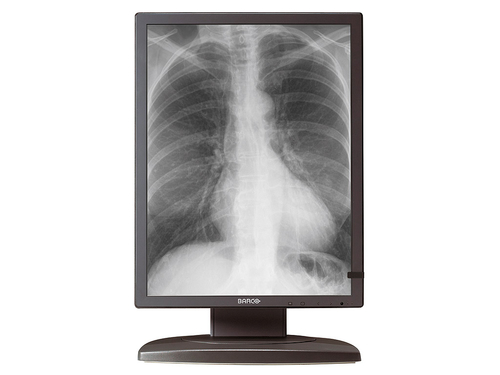 Barco MDCG-3120 computer monitor