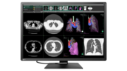 12MP EIZO RADIFORCE RX1270