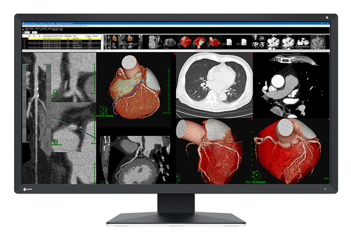 8MP EIZO RADIFORCE MX317W 31IN