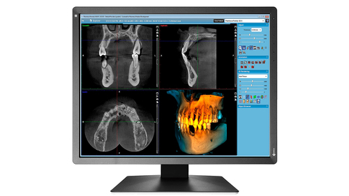 EIZO RadiForce MX216-SB computer monitor