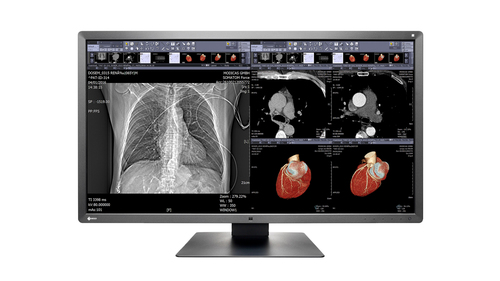 EIZO RadiForce MX315W computer monitor
