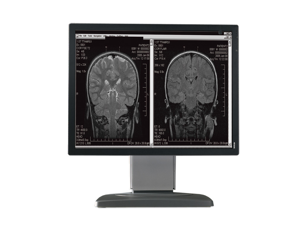 Barco MDCG-2121 computer monitor 54.1 cm (21.3″) 1600 x 1200 pixels LED Grey image 1