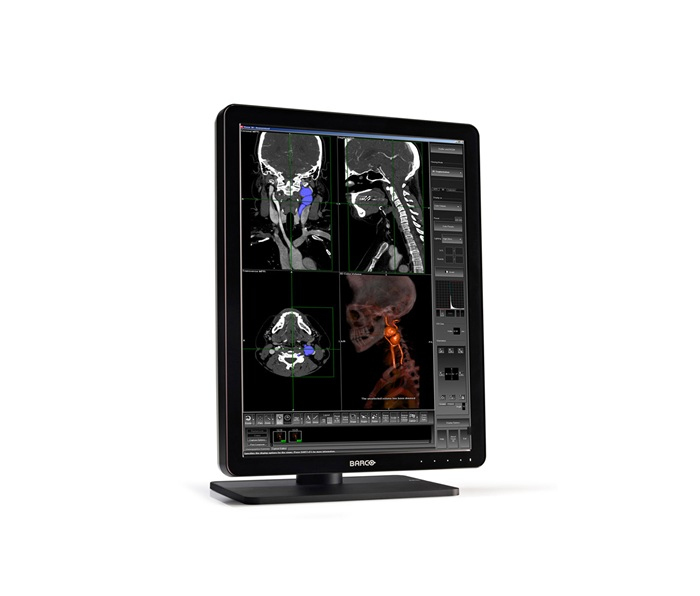 Barco MDNC-3321 computer monitor 54.1 cm (21.3″) 2048 x 1536 pixels LED Black image 1