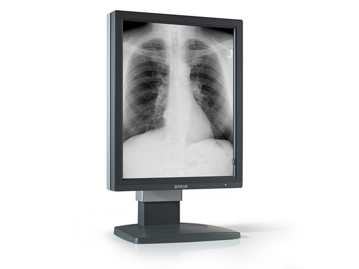 Barco MDCG-5121 computer monitor 54.1 cm (21.3″) 2560 x 2048 pixels LED Black image 1