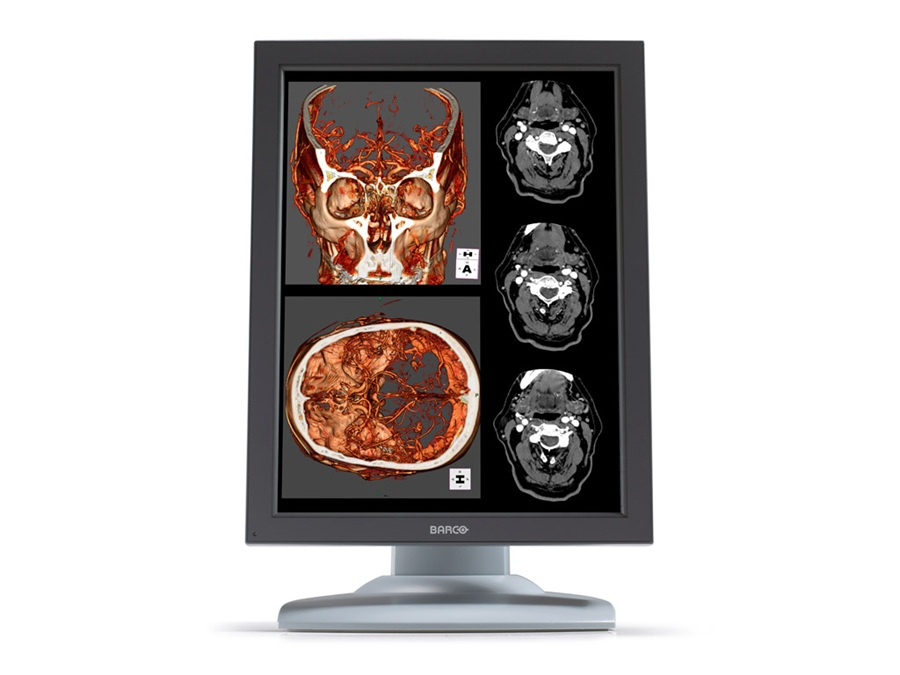 Barco MDNC-2121 computer monitor 54.1 cm (21.3″) 1600 x 1200 pixels LED Grey image 1