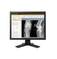 EIZO EIZO RadiForce MX210 54,1 cm (21.3 Zoll) 1600 x 1200 Pixel Schwarz https://images.icecat.biz/img/norm/low/10688216-4409.jpg EIZO EIZO RadiForce MX210 54,1 cm (21.3 Zoll) 1600 x 1200 Pixel Schwarz https://images.icecat.biz/img/norm/low/10688216-4409.jpg