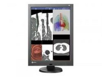 EIZO EIZO RadiForce RX240 54,1 cm (21.3 Zoll) 1200 x 1600 Pixel Schwarz https://images.icecat.biz/img/norm/low/15539081-9586.jpg EIZO EIZO RadiForce RX240 54,1 cm (21.3 Zoll) 1200 x 1600 Pixel Schwarz https://images.icecat.biz/img/norm/low/15539081-9586.jpg